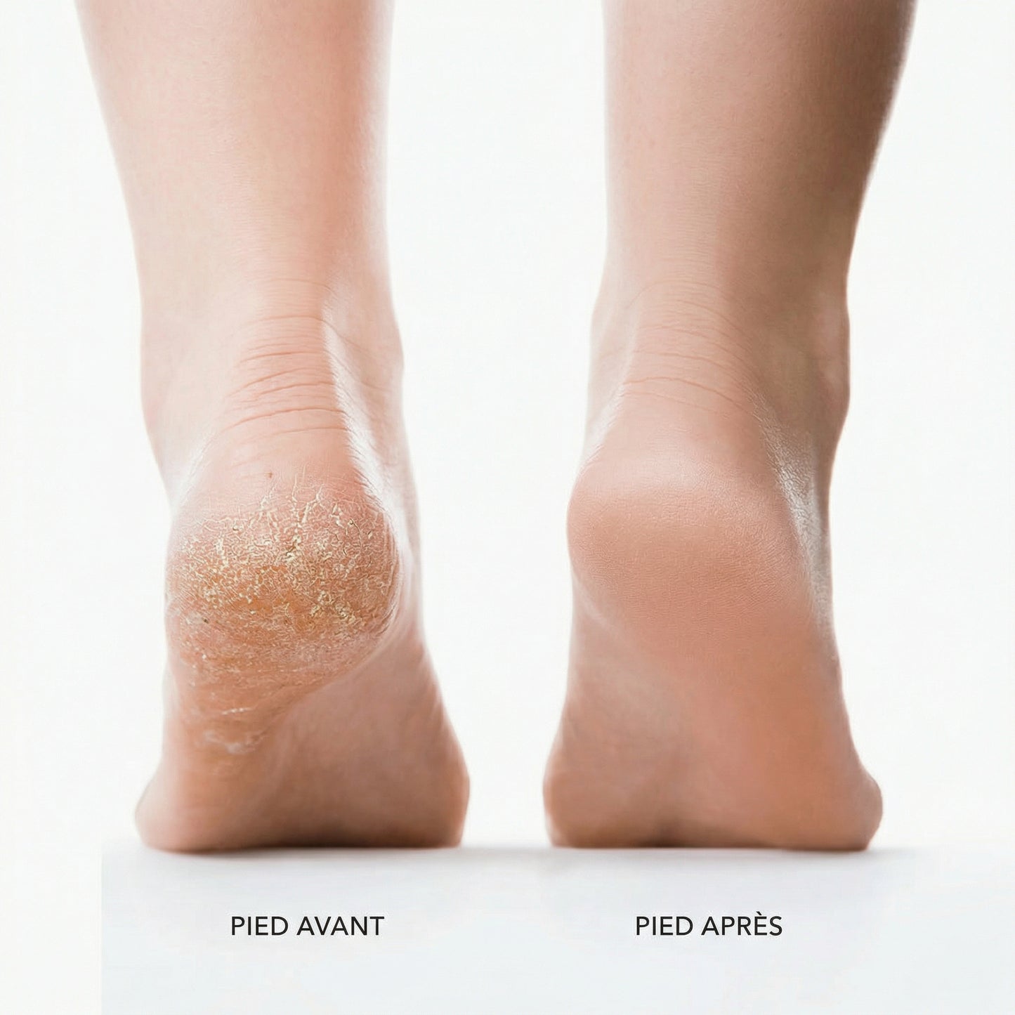 Lissio™ Pédicure Pro